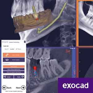 Otwarte rozwiązania CAD/CAM dla stomatologii