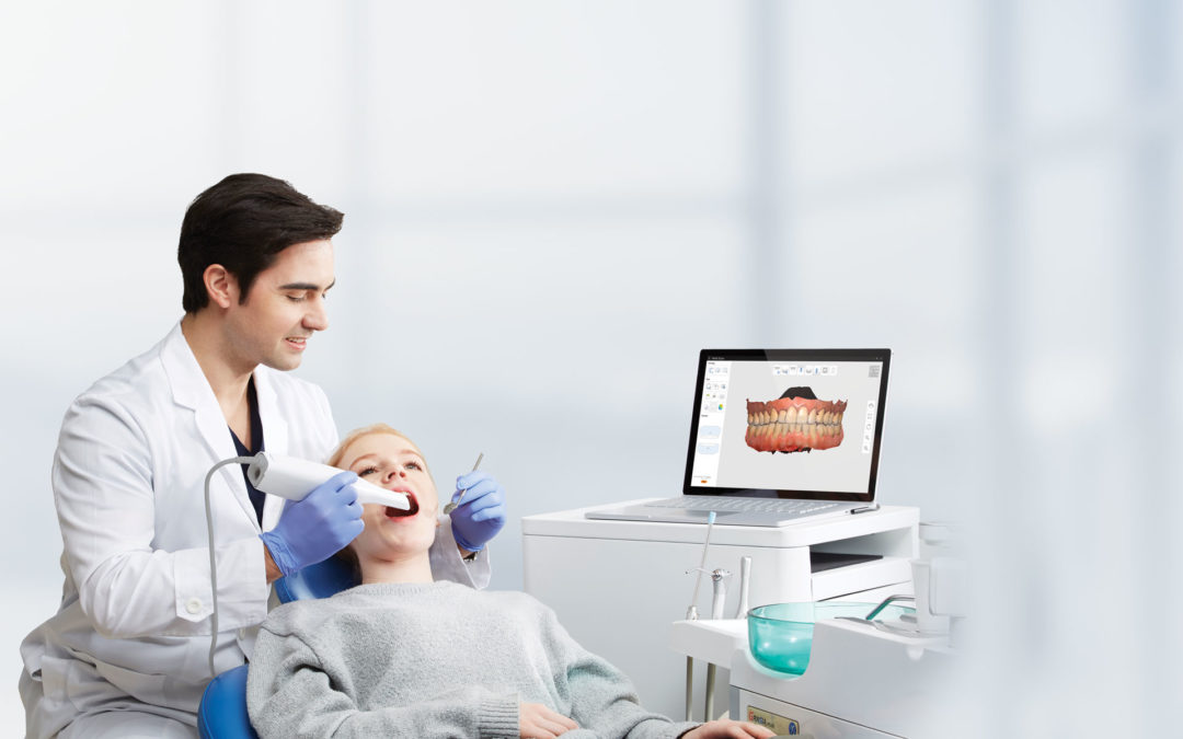 Porównanie skanerów wewnątrzustnych