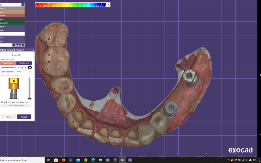 Jak zainstalować biblioteki w exocad?