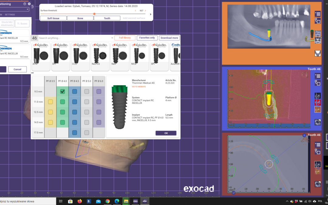 Jak zainstalować biblioteki w exoplan?