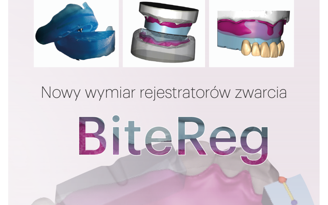R2 BiteReg – nowość na polskim rynku protetyki