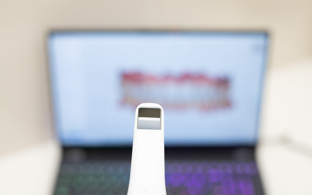 Skaner wewnątrzustny Medit i500: Jak czyścić i sterylizować?