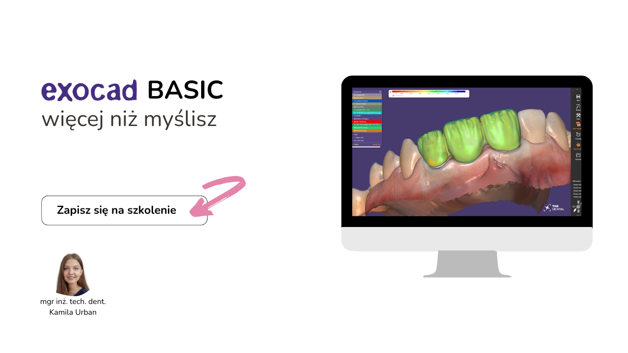 Szkolenie exocad Basic więcej niż myślisz